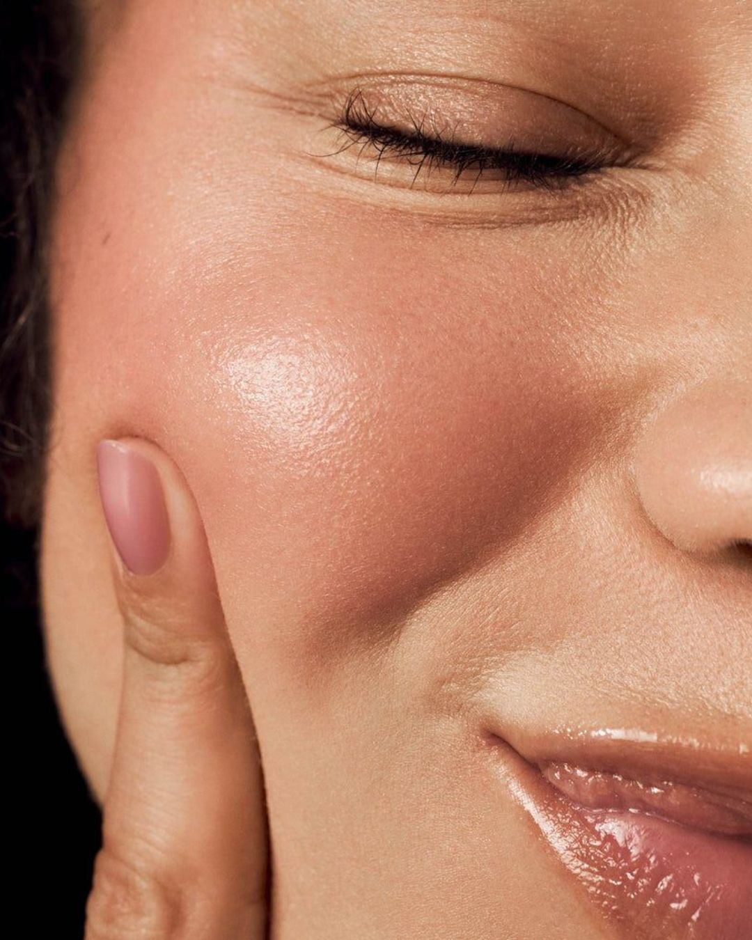 Tratamiento HIFU facial para firmeza y óvalo facial en Bilbao